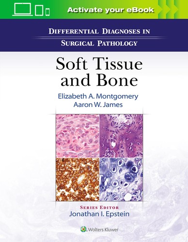Differential Diagnoses In Surgical Pathology Soft Tissue And Bone 1st Edition Elizabeth A Montgomery