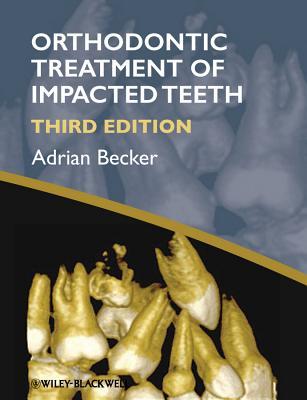 Orthodontic Treatment Of Impacted Teeth 3 Ed Becker Adrian