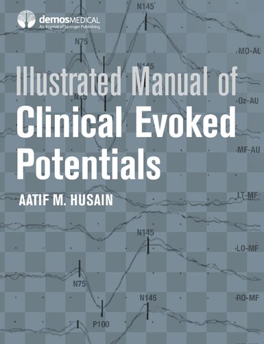 Illustrated Manual Of Clinical Evoked Potentials Aatif Husain