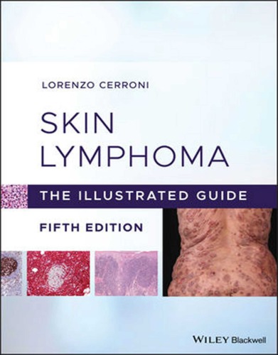 Skin Lymphoma The Illustrated Guide Fifth Edition Cerroni Lorenzo