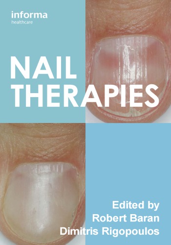 Nail Therapies Onlineausg Baran Robertrigopoulos Dimitris