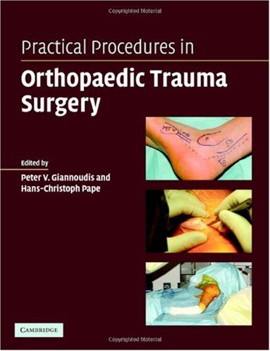 Practical Procedures In Orthopaedic Trauma Surgery 1st Edition Peter V Giannoudis
