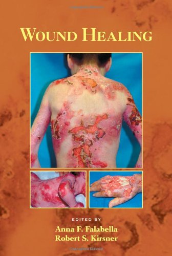 Wound Healing Basic And Clinical Dermatology 1st Edition Anna Falabella