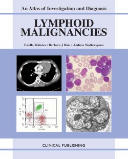 Lymphoid Malignancies An Atlas Of Investigation And Management 1st Edition Barbara J Bain