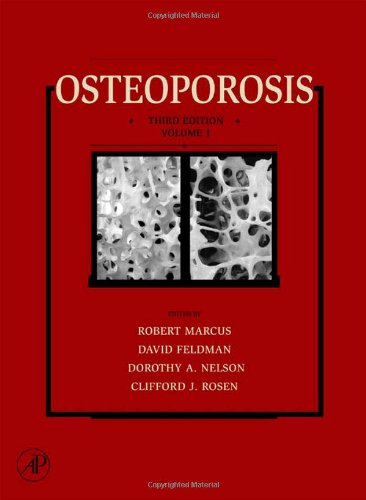 Osteoporosis Twovolume Set Volume 12 Third Edition 3rd Edition Robert Marcus