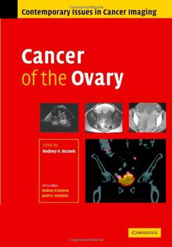 Cancer Of The Ovary Contemporary Issues In Cancer Imaging 1st Edition Rodney Reznek