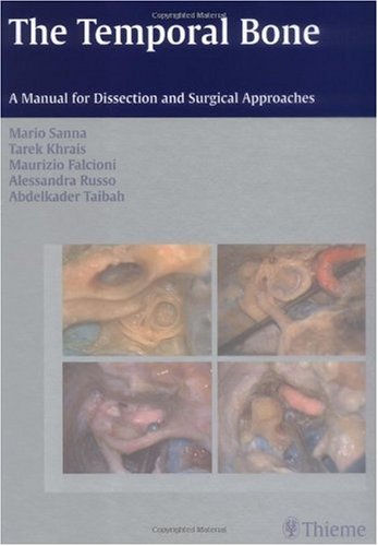 The Temporal Bone A Manual For Disection And Surgical Approaches 1st Edition Mario