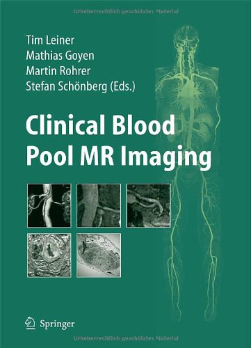 Clinical Blood Pool Mr Imaging The Vasovist Product Monograph 1st Edition Tim Leiner