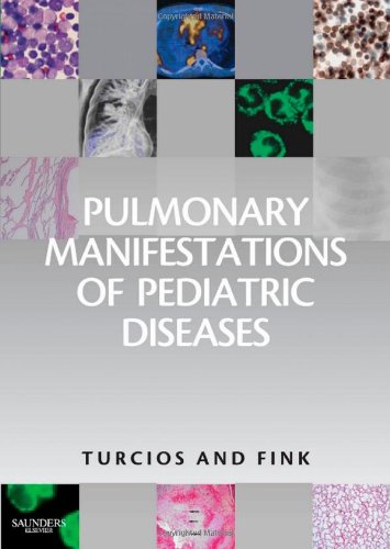 Pulmonary Manifestations Of Pediatric Diseases 1st Edition Nelson L Turcios Md