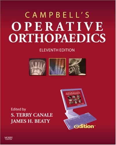 Campbells Operative Orthopaedics Edition Text With Continually Updated Online Reference 11th Edition S Terry Canale Md