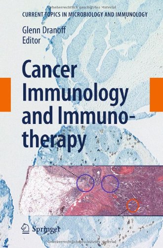Cancer Immunology And Immunotherapy 1st Edition Wolf H Fridman