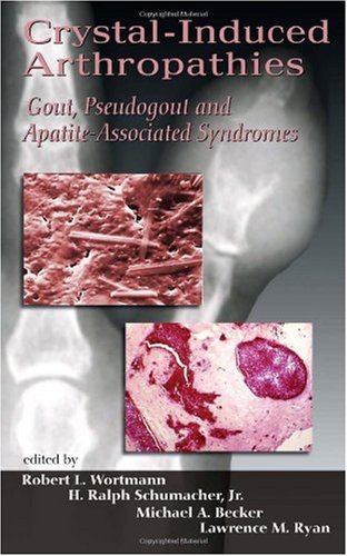 Crystalinduced Arthropathies Gout Pseudogout And Apatiteassociated Syndromes 1st Edition Robert L Wortmann