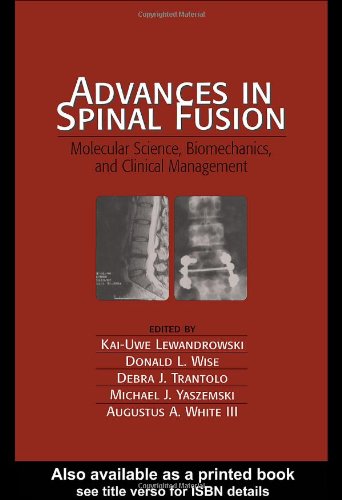 Advances In Spinal Fusion Molecular Science Biomechanics And Clinical Kaiuwe Lewandrowski
