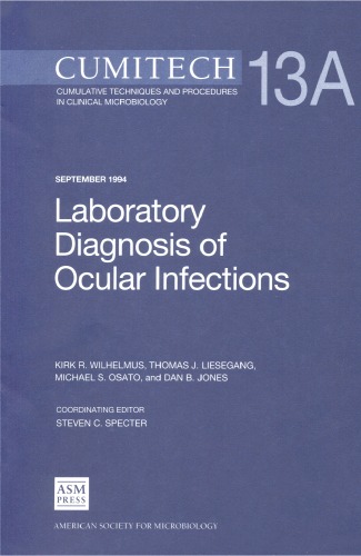 Cumitech 13b Laboratory Diagnosis Of Ocular Infections 1st Edition James W Snyder