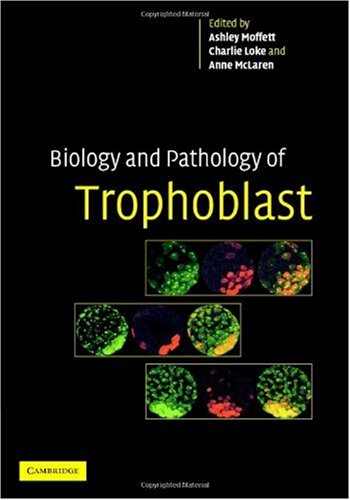 Biology And Pathology Of Trophoblast 1st Edition Ashley Moffett