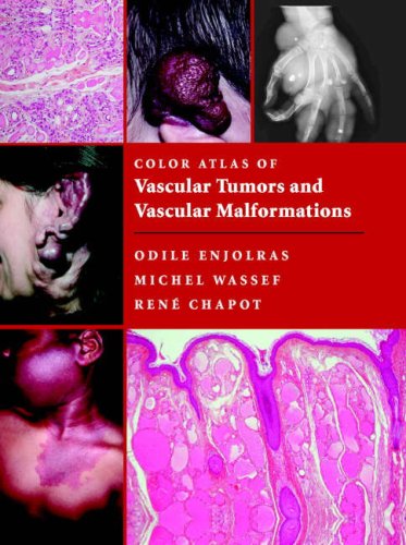 Color Atlas Of Vascular Tumors And Vascular Malformations 1st Edition Odile Enjolras