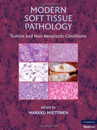 Modern Soft Tissue Pathology Tumors And Nonneoplastic Conditions 1st Edition Markku Miettinen Editor