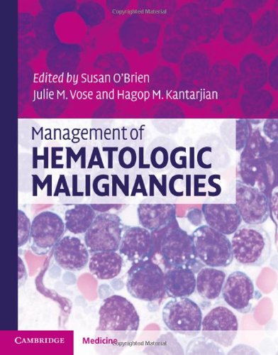 Management Of Hematologic Malignancies 1st Edition Susan Obrien Editor