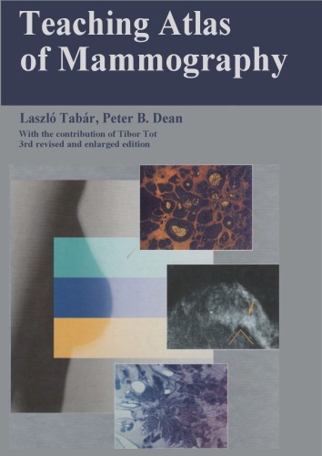 Teaching Atlas Of Mammography Lszl Tabr Peter B Dean Tibor Tot