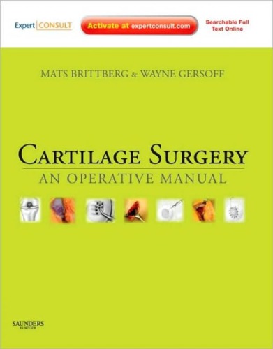 Cartilage Surgery An Operative Manual Expert Consult Online And Print Mats Brittberg Md Phd