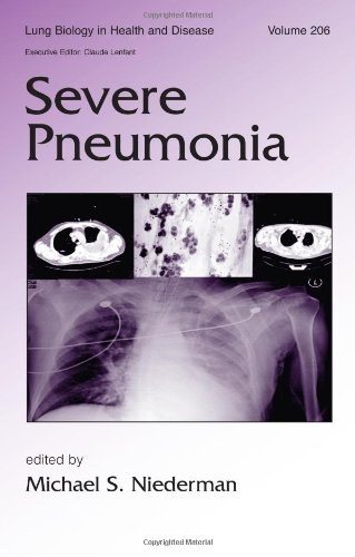 Severe Pneumonia Lung Biology In Health And Disease Volume 206 1st Edition Michael S Niederman