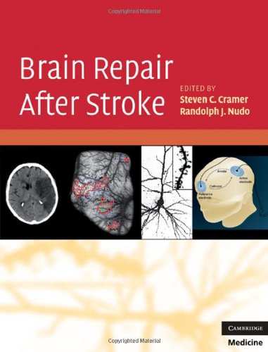 Brain Repair After Stroke 1st Edition Steven C Cramer Md Randolph J Nudo Phd