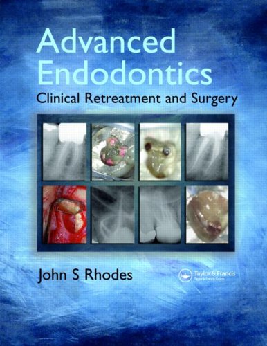 Advanced Endodontics Clinical Retreatment And Surgery 1st Edition Js Rhodes