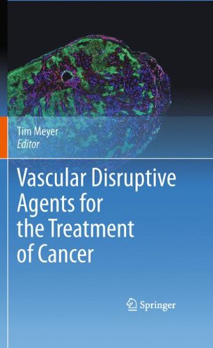 Vascular Disruptive Agents For The Treatment Of Cancer 1st Edition Graeme J Dougherty