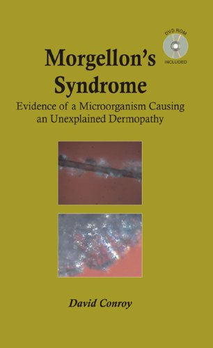 Morgellons Syndrome 1 Papcdr David Conroy