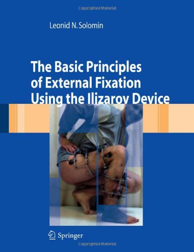 The Basic Principles Of External Skeletal Fixation Using The Ilizarov Device 1st Edition Leonid Solomin