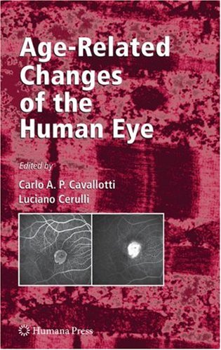 Agerelated Changes Of The Human Eye 1st Edition Luciano Cerulli Md