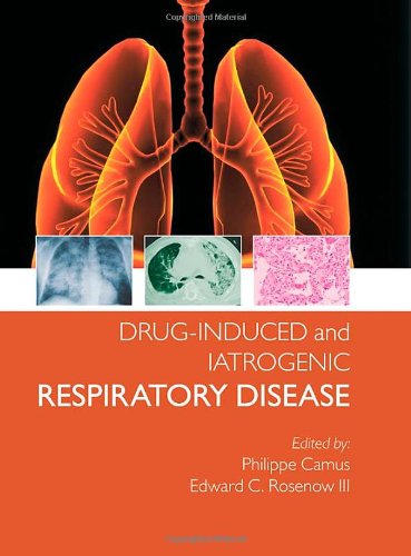 Drug Induced And Iatrogenic Lung Disease Hodder Arnold Publication 1st Edition Philippe Camus