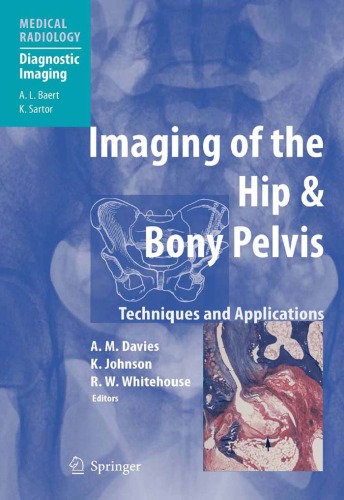 Imaging Of The Hip Bony Pelvis Techniques And Applications Medical Radiology Diagnostic Imaging A Mark Davies
