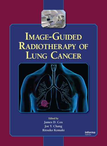 Imageguided Radiotherapy Of Lung Cancer James D Cox Joe Y Chang