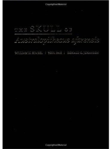 The Skull Of Australopithecus Afarensis William H Kimbel Yoel Rak
