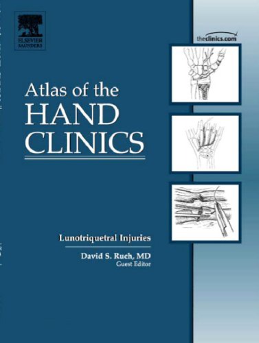 Nerve Repair And Reconstruction An Issue Of Atlas Of The Hand Clinics The Clinics Orthopedics 1st Edition David J Slutsky Md Frcs