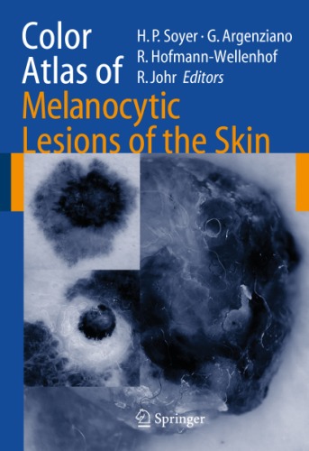 Color Atlas Of Melanocytic Lesions Of The Skin H P Soyer G Argenziano R Hofmannwellenhof