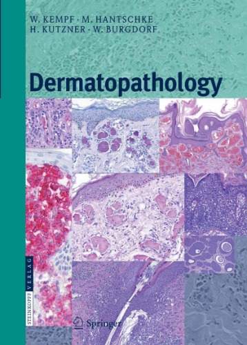 Dermatopathology Werner Kempf M Hantschke Heinz Kutzner Walter Hc Burgdorf