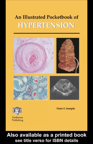 An Illustrated Pocketbook Of Hypertension Peter F Semple