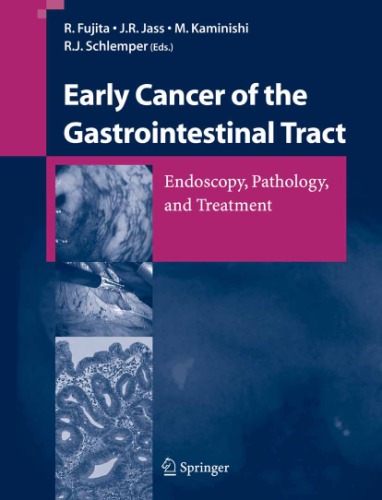 Early Cancer Of The Gastrointestinal Tract Endoscopy Pathology And Treatment R Fujita