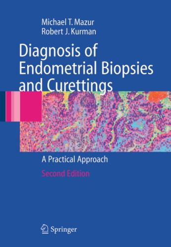 Diagnosis Of Endometrial Biopsies And Curettings Michael T Mazur