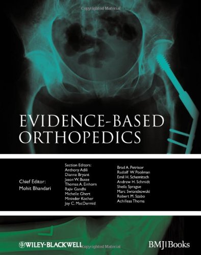 Evidencebased Orthopedics Evidencebased Medicine 1st Edition Mohit Bhandari