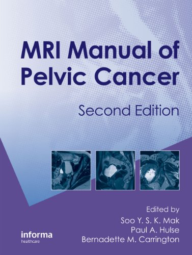Mri Manual Of Pelvic Cancer Second Edition 2nd Soo Mak Paul A Hulse