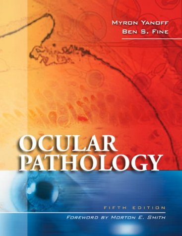 Ocular Pathology 5th Edition 5th Edition Myron Yanoff Md Ben S Fine Md