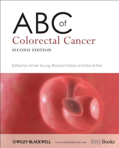 Abc Of Colorectal Cancer 2nd Edition Young Annie Young Richard Hobbs