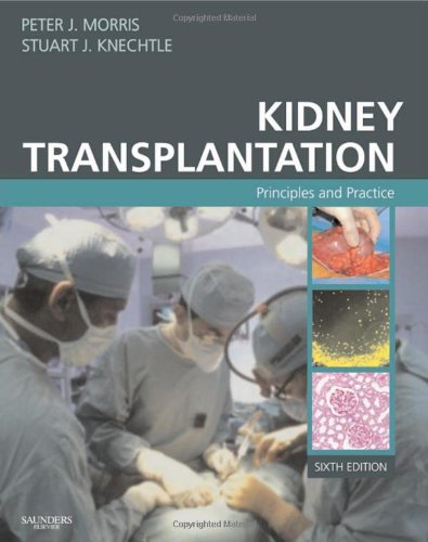 Kidney Transplantation Principles And Practice 6th Edition Morriskidney Transplantation 6th Edition Peter Morris