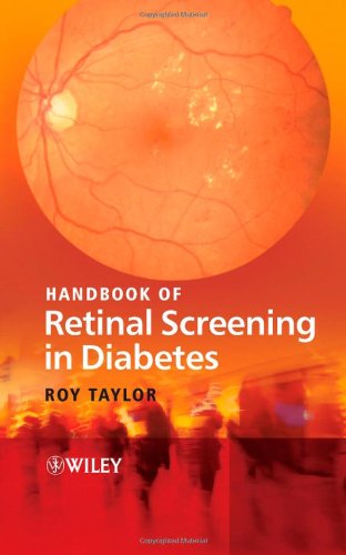 Handbook Of Retinal Screening In Diabetes 1st Edition Roy Taylor