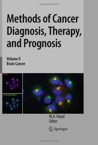 Methods Of Cancer Diagnosis Therapy And Prognosis Brain Cancer 1st Edition Shiori Amemiya Auth