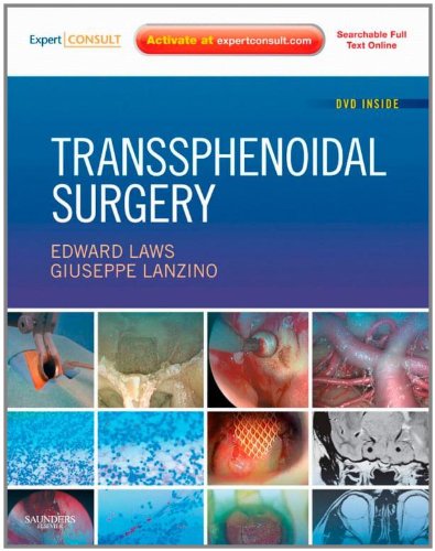 Transsphenoidal Surgery Expert Consult Online And Print 1 Harpsc Edward R Laws Md Phd