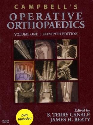Campbells Operative Orthopaedics 4volume Set 11th Edition 11th S Terry Canale Md